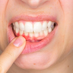Woman with an infected tooth