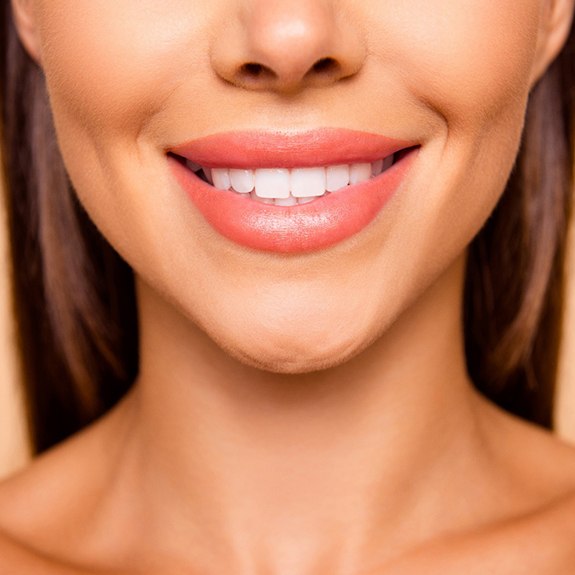 Closeup of woman smiling with veneers
