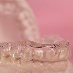 Model teeth wear nightguard