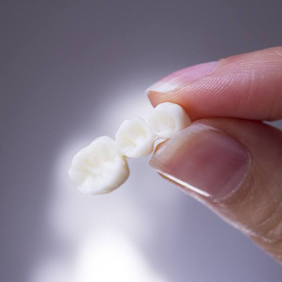 Someone holding a dental bridge