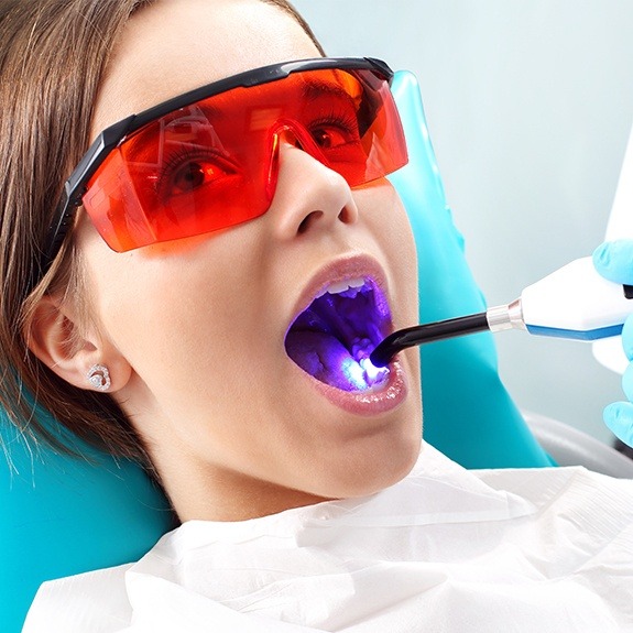 Dentist placing dental sealants