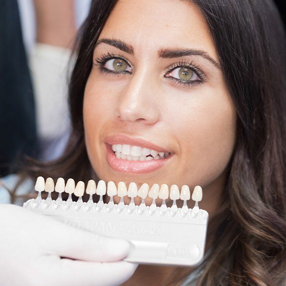 Woman's smile compared with porcelain veneer shade chart