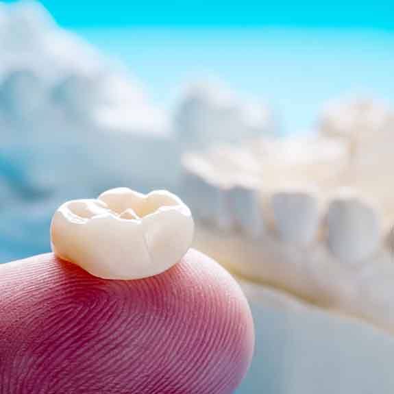 Dental crowns can range in cost depending on a variety of factors