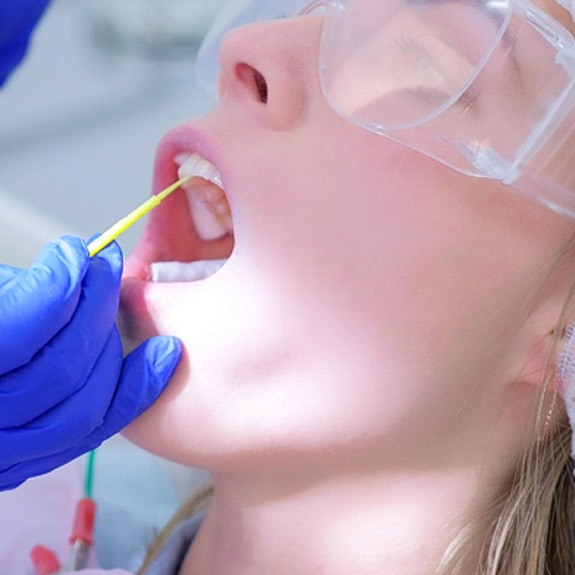 A dentist applies fluoride to a young patient’s teeth