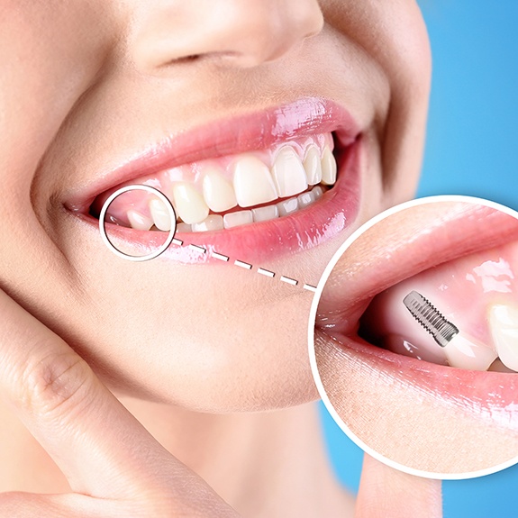 a close-up of a patient’s teeth 