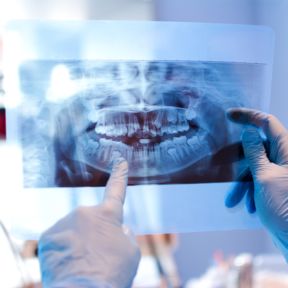 Digital dental x-rays