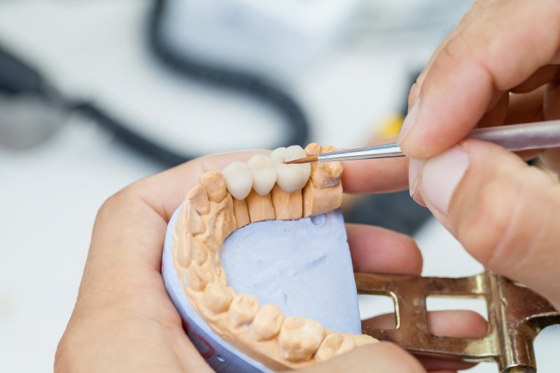 A dentist preparing a dental crown for a patient